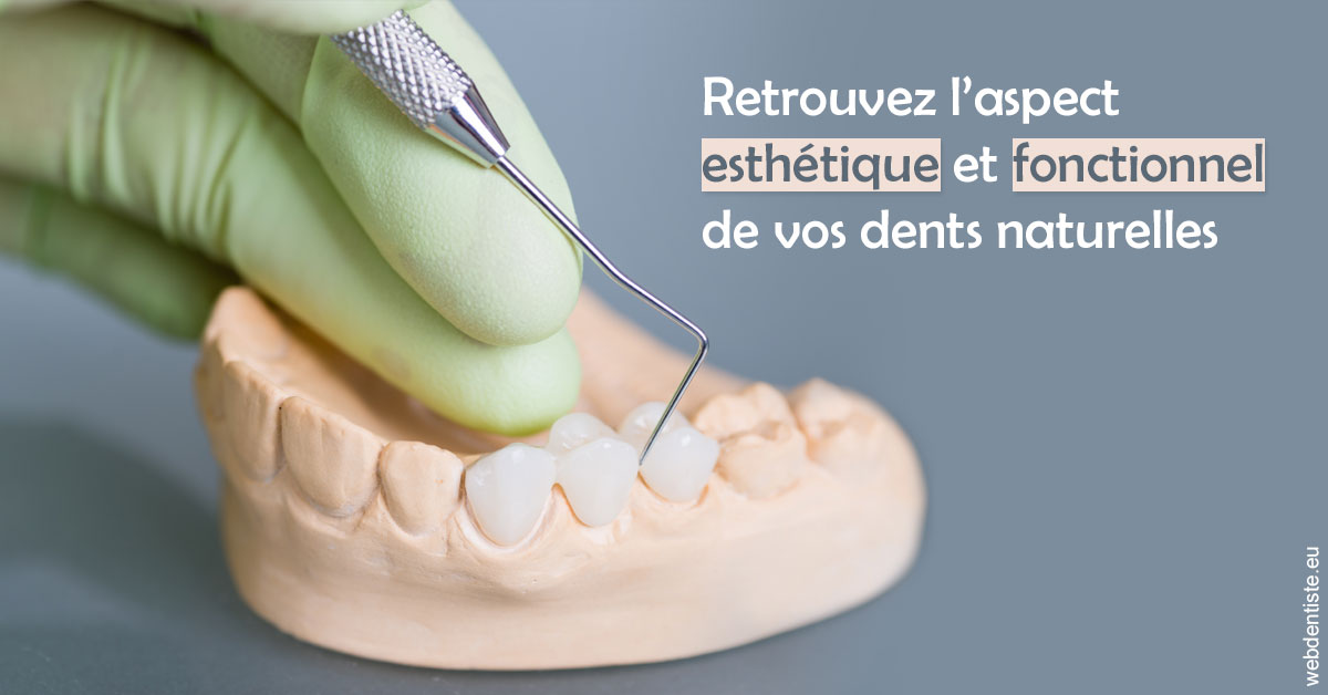 https://dr-strimon-frederic.chirurgiens-dentistes.fr/Restaurations dentaires 1