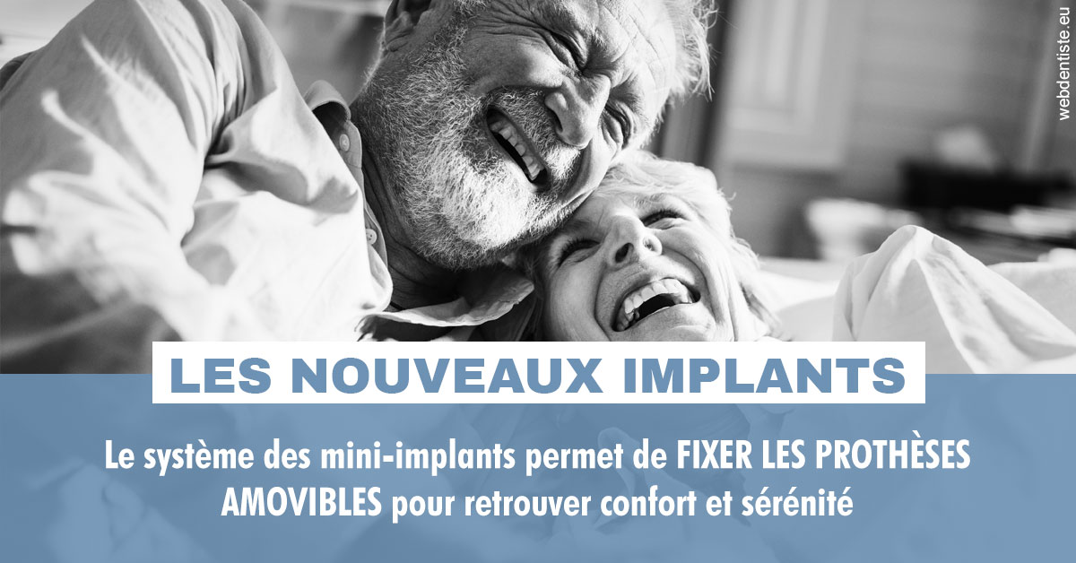 https://dr-strimon-frederic.chirurgiens-dentistes.fr/Les nouveaux implants 2