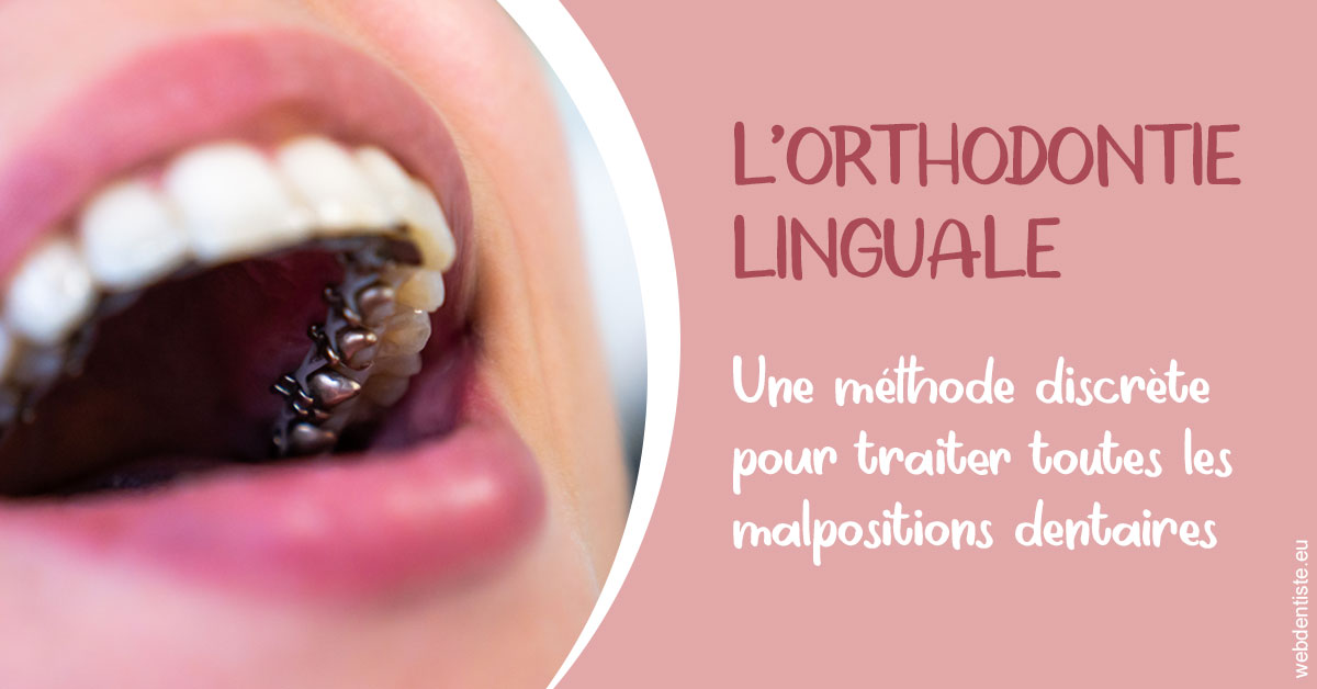 https://dr-strimon-frederic.chirurgiens-dentistes.fr/L'orthodontie linguale 2