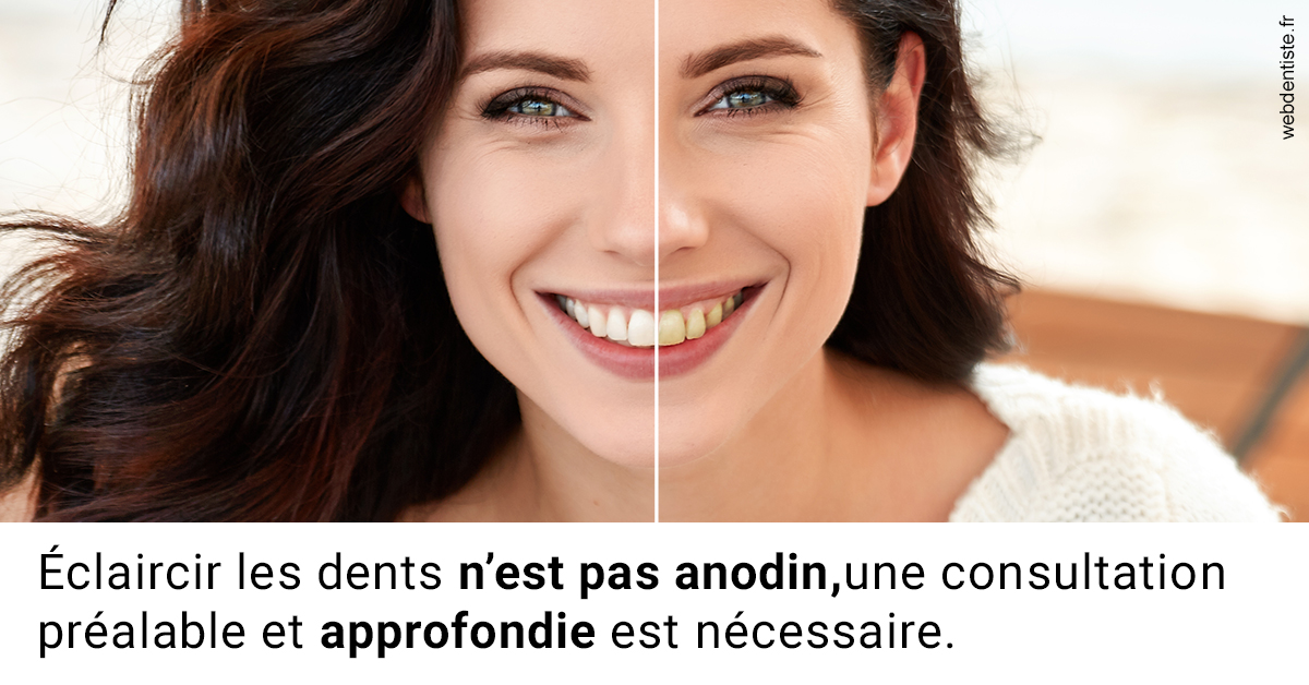 https://dr-strimon-frederic.chirurgiens-dentistes.fr/Le blanchiment 2