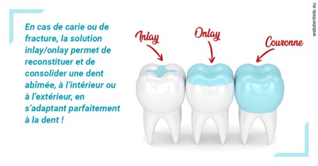 https://dr-strimon-frederic.chirurgiens-dentistes.fr/L'INLAY ou l'ONLAY
