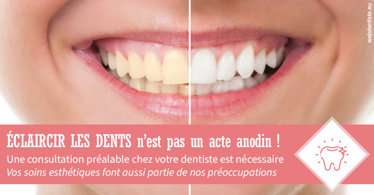 https://dr-strimon-frederic.chirurgiens-dentistes.fr/Eclaircir les dents 1