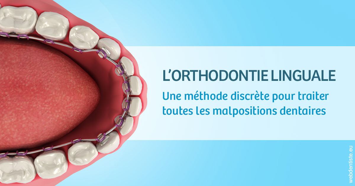 https://dr-strimon-frederic.chirurgiens-dentistes.fr/L'orthodontie linguale 1