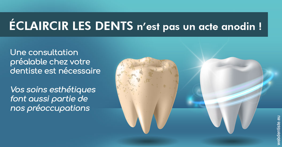 https://dr-strimon-frederic.chirurgiens-dentistes.fr/Eclaircir les dents 2