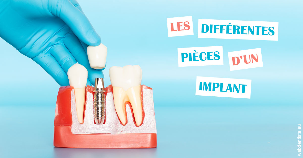 https://dr-strimon-frederic.chirurgiens-dentistes.fr/Les différentes pièces d’un implant 2