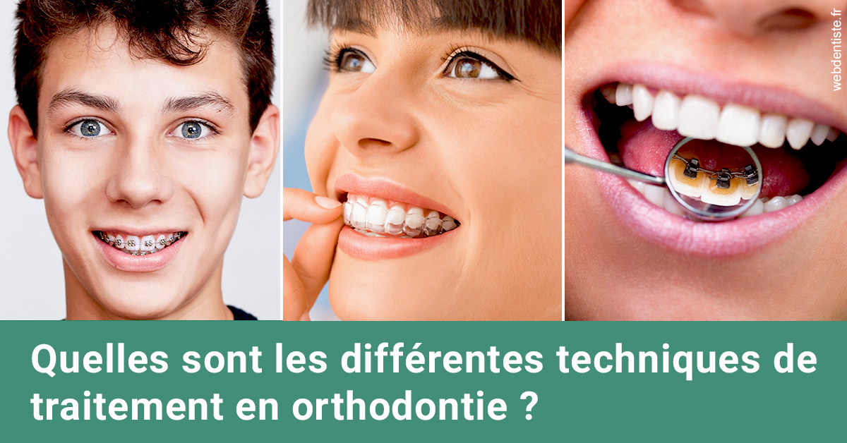 https://dr-strimon-frederic.chirurgiens-dentistes.fr/Les différentes techniques de traitement 2
