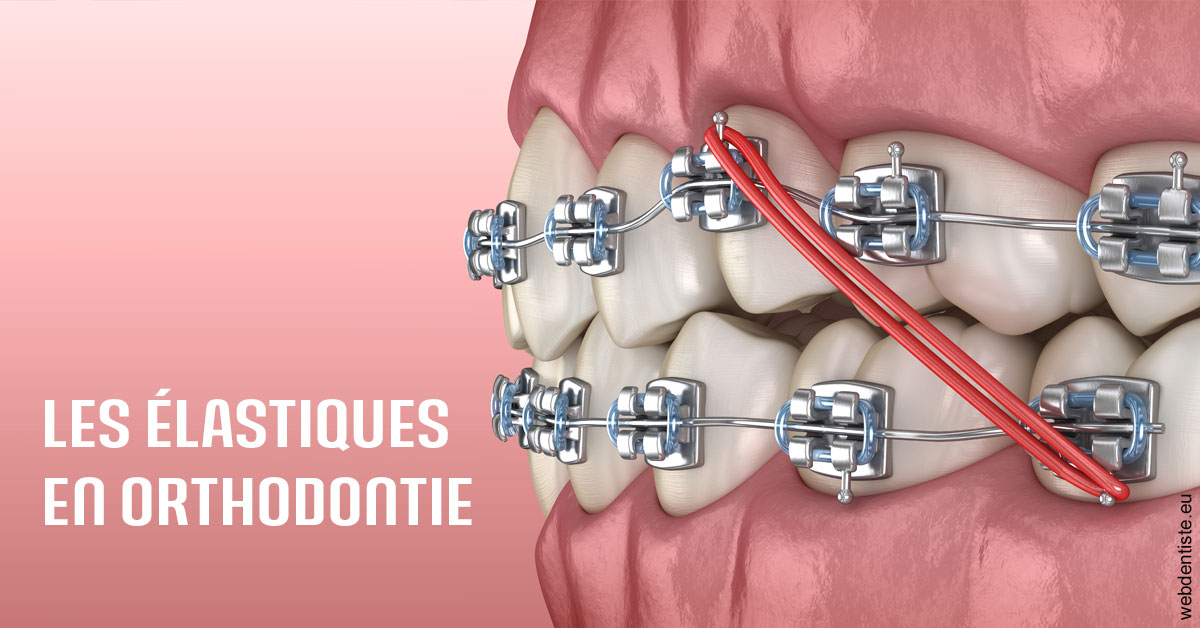 https://dr-strimon-frederic.chirurgiens-dentistes.fr/Elastiques orthodontie 2