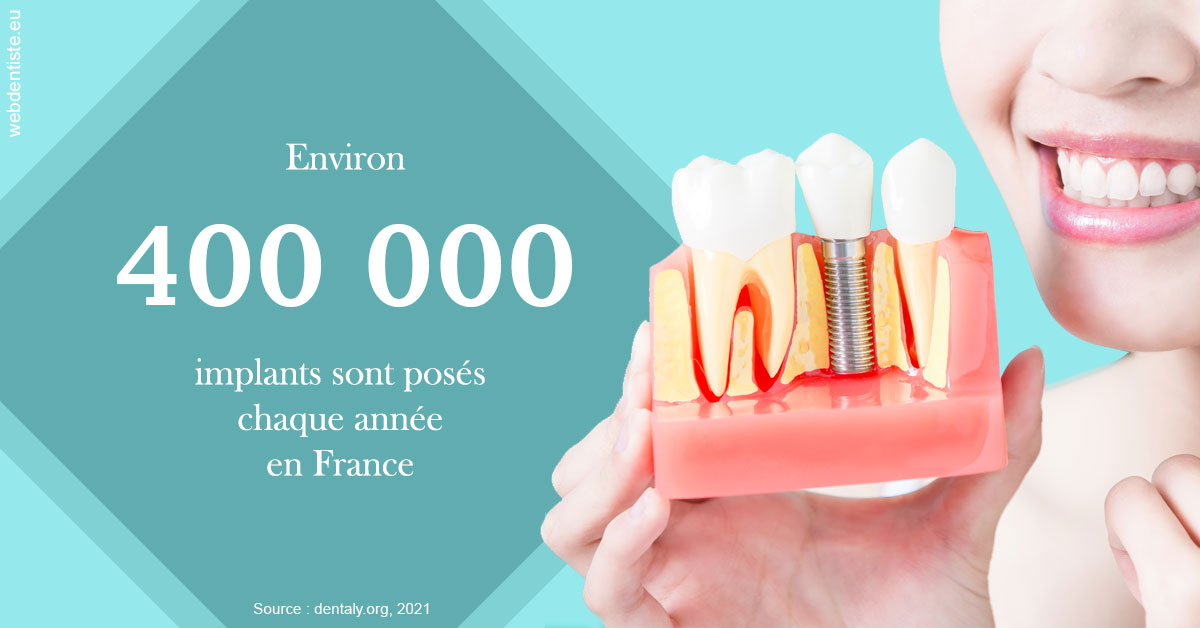 https://dr-strimon-frederic.chirurgiens-dentistes.fr/Pose d'implants en France 2